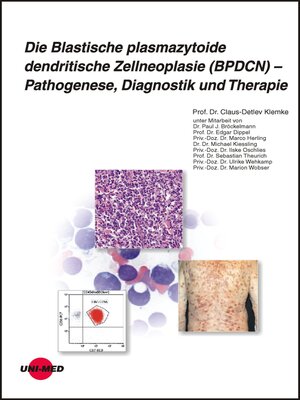 cover image of Die Blastische plasmazytoide dendritische Zellneoplasie (BPDCN) – Pathogenese, Diagnostik und Therapie